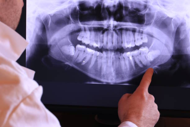 Best Emergency Dental Care for Broken or Chipped Teeth in Cimarron Hills, CO